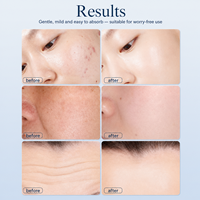 GHK-Cu Peptide de Cuivre Bleu pour l'Exportation, Poudre Lyophilisée 50mg/100mg, Kit Collagène Éclaircissant Hydratant