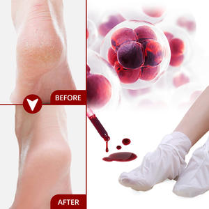 Masque exfoliant pour les pieds à l'acide de fruits végétalien naturel personnalisé avec logo - Product Image 3