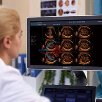 Mesin Ultrasound Diagnostik Sonoscape P50 dengan Doppler Warna 4D dan Troli untuk Pemeriksaan Kehamilan
