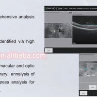 Mesin OCT Otomatis Penuh Harga Pabrik Murah Ophthalmic Optical Coherence Tomography OCT-50 Resolusi Aksial 6 Um Pemindaian 6-12mm