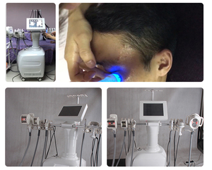 Body Shaping Slimming Machine Automatic <b>Roller</b> Cellulite <b>Roller</b> Face Body <b>Roller</b> Equipment - Product Image 6