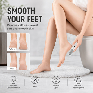 Removedor de Callos Eléctrico Recargable con 2 Cabezales de Pulido, Carga Tipo-C, Herramienta de Pedicura para Eliminar Piel Muerta de los Pies - Product Image 3
