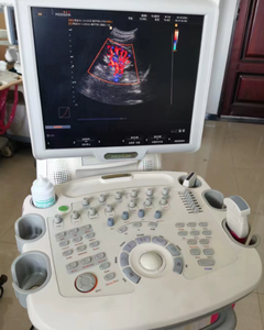 Servicio de Reparación de Máquinas de Ultrasonido Voluson E10, Sistema de Ultrasonido Doppler a Color 4D Reacondicionado, Imágenes en Vivo de Alta Definición, Ultrasonido Obstétrico - Product Image 6