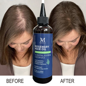 Großhandel 200ml Rosmarin-Haaröl Haarstärkung Haarpflege Rosmarinöl Regelmäßige Anwendung Reines Rosmarin-Haaröl - Product Image 1