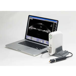 เครื่องสแกนอัลตร้าโซนิ<span class=keywords><strong>ค</strong></span>อุปกรณ์เกี่ยวกับจักษุวิทยาเครื่องสแกนอัลตร้าซาวด์แบบพกพาอุปกรณ์ SW-2100 - Product Image 1