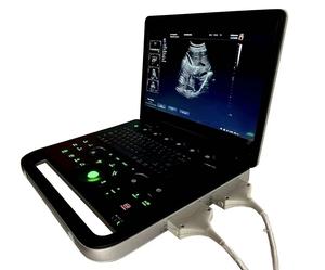 15 Inch Led Touchscreen Cardiale Zwangerschap Laptop Echografie 3d 4d - Product Image 4