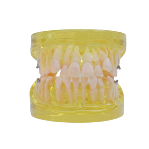 Modelo de Práctica de <span class=keywords><strong>Implantes</strong></span> <span class=keywords><strong>Dentales</strong></span> para Prótesis Totales, Modelo de Enseñanza de Prótesis Orales, Modelo Anatómico de <span class=keywords><strong>Implantes</strong></span> <span class=keywords><strong>Dentales</strong></span> - Product Image 2