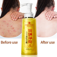 Gel Douche au Soufre Anti-Acné 500ml – Élimine les Acariens, Nettoyage en Profondeur, Blanchissant, Contrôle du Sébum pour la Peau du Corps