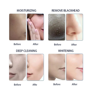 Nueva máquina portátil de dermoabrasión facial Aqua 8 en 1 con oxígeno para lifting facial y cuidado de la piel. - Product Image 6