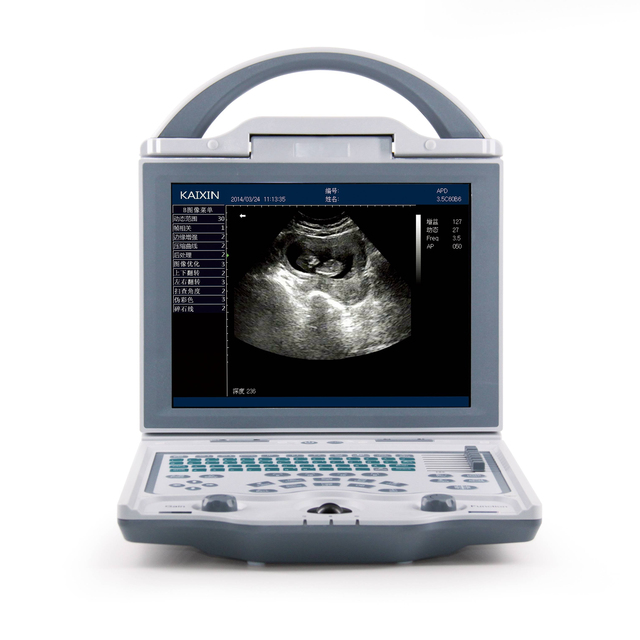 B&W Ultrasound Machine Medical Diagnostic Imaging Equipment Portable 2d UltrasoundPortable Laptop Ultrasound Machine