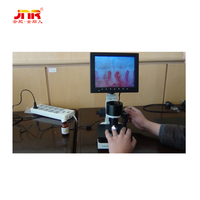 High-Resolution Nailfold Microcirculation Microscope for Medical Diagnostics