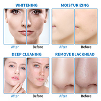 Máquina de Belleza 6 en 1 para Hidrodermoabrasión Facial, Exfoliante, Máquina de Microdermoabrasión Hidráulica