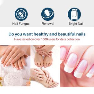 Solution réparatrice d'essence traitement <span class=keywords><strong>antifongique</strong></span> des ongles d'orteil pour les champignons des ongles d'orteil et des ongles - Product Image 2