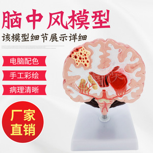 Modèle d'enseignement simulé de l'anatomie du cerveau ; outil pédagogique pour l'enseignement de l'anatomie pathologique du cerveau humain ; modèle des voies vasculaires et de la structure cérébrales - Product Image 3