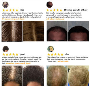 Kit de Croissance Capillaire Marque Blanche Sérum à l'Argan et à la Biotine Solution Anti-Chute Renforçant les Racines - Product Image 5