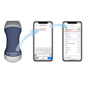 1 ट्रांसड्यूक्टर अल्ट्रासाउंड में 1 ट्रांसड्यूसर अल्ट्रासाउंड रैखिक सरणी उच्च आवृत्ति रंग डॉपलर अल्ट्रासाउंड जांच मिनी अल्ट्रासाउंड - Product Image 1