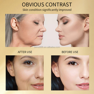 ニアシンアミドヒアルロン酸アンチリンクルフェイス<span class=keywords><strong>24K</strong></span>ゴールド血清フェイシャルスキンケア - Product Image 5