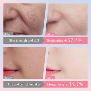 Органический коллагеновый набор SADOER с экстрактом сакуры для осветления и увлажнения кожи, 6 предметов, собственная торговая марка, отбеливающий и увлажняющий набор для ухода за кожей лица - Product Image 4