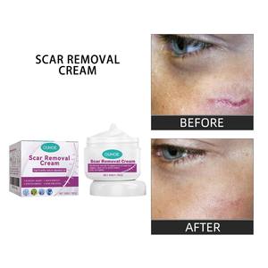 Crema Herbal para Eliminar Cicatrices, Aclara y Suaviza la Piel, Repara Cicatrices Quirúrgicas, Revitaliza la Piel Traumatizada - Product Image 2