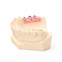Implants dentaires Elcon en zircone, piliers d'implants dentaires de haute précision, piliers multi-unités en titane pour restauration dentaire