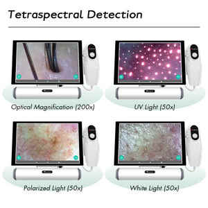 Analizzatore Intelligente per la Pelle del Cuoio Capelluto e i Follicoli Piliferi con Touch Screen e Sistema Operativo in Vendita Diretta dalla Fabbrica - Product Image 6