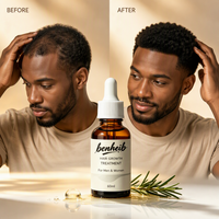 Huile Capillaire Naturelle Anti-Chute de Cheveux, Traitement du Cuir Chevelu à Base de Peptides Végétaux Biologiques, Bloqueur de DHT, Professionnel