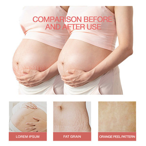 Mới tự nhiên Công thức khử muối của mẹ tinh dầu căng kem đánh dấu cơ thể sử dụng kem dầu - Product Image 3