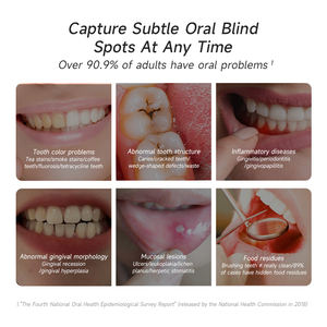 Meiboyi pemindai periksa gigi genggam HD 1080P, kamera pendeteksi gigi untuk mulut dengan layar 11 inci & pegangan untuk penggunaan di rumah - Product Image 5