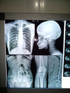 Pellicola Radiografica Termica Blu Personalizzata per Imaging a Secco, Base Blu per Toner <span class=keywords><strong>Laser</strong></span> Medico - Product Image 5