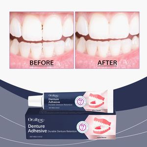 ORALHOE Vente en gros 40g Autocollants dentaires sans zinc <span class=keywords><strong>pour</strong></span> prothèses, ajustement confortable, maintien longue durée, fabriqués <span class=keywords><strong>pour</strong></span> une rétention durable des prothèses - Product Image 2