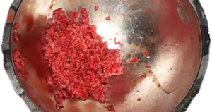 Tandheelkundige Chirurgische Instrumenten Bot Curette - Product Image 5