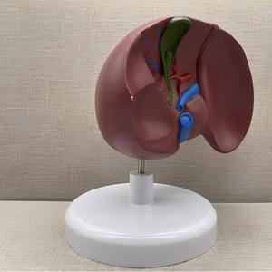 Modèle du Foie et de la Vésicule Biliaire Pathologique - Outil Pédagogique en Hépatologie - Product Image 3