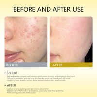 Planche de massage Gua Sha pour le visage, éclaircissement de la peau, contrôle du sébum, anti-inflammatoire, réduit les gonflements, tous types de peau