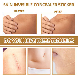 Jaysuing pelle invisibile correttore cicatrice tatuaggio segno di Acne che copre Patch di tono della pelle cerotto invisibile impermeabile - Product Image 3