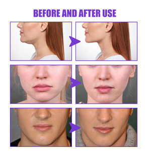 Atacado JAYSUING Melhor Pele Face Lift Firming V Forma Creme 30g Emagrecimento Creme para Rosto - Product Image 3