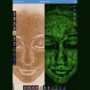Système d'analyse cutanée numérique 3D Meicet MC88 avec scanner d'analyse faciale et prises IT JP pour équipement d'analyse - Product Image 4