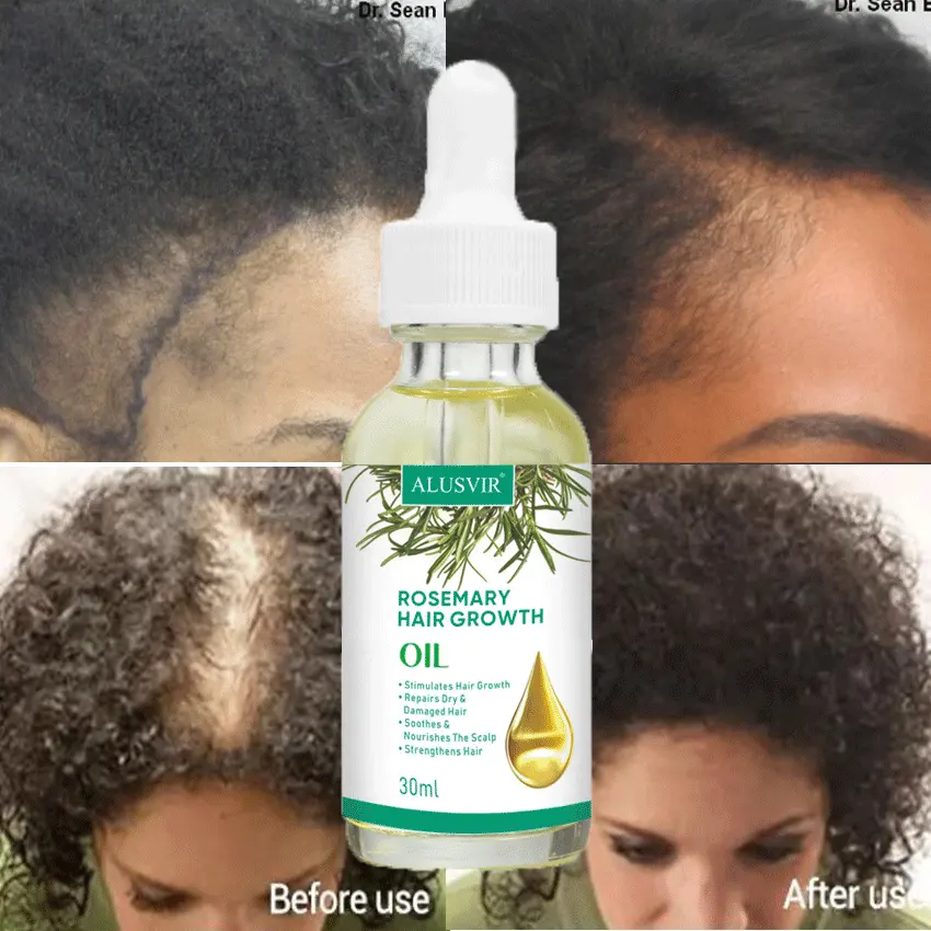 Private Label Natural Organic Rosmarin ätherisches Öl Frauen Schwarz Haarpflege produkte Rosmarin öl Haarwuchs für schwarze Frauen