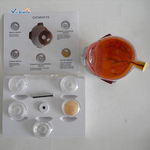 Modelo de Cataratas de Alta Calidad, Modelo de Glaucoma, Modelo de Ojo Patológico para Educación y Enseñanza. - Product Image 3
