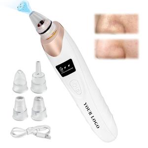 Dispositivo de Succión para Puntos Negros 0728 con Carga USB y Potente Succión para Limpieza Facial de Poros - Product Image 4