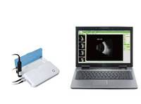 A Scan Biométrie Ophtalmologie SP-2000 A/B Scan Poids léger Biométrie Ophtalmologie Pachymètre ophtalmique