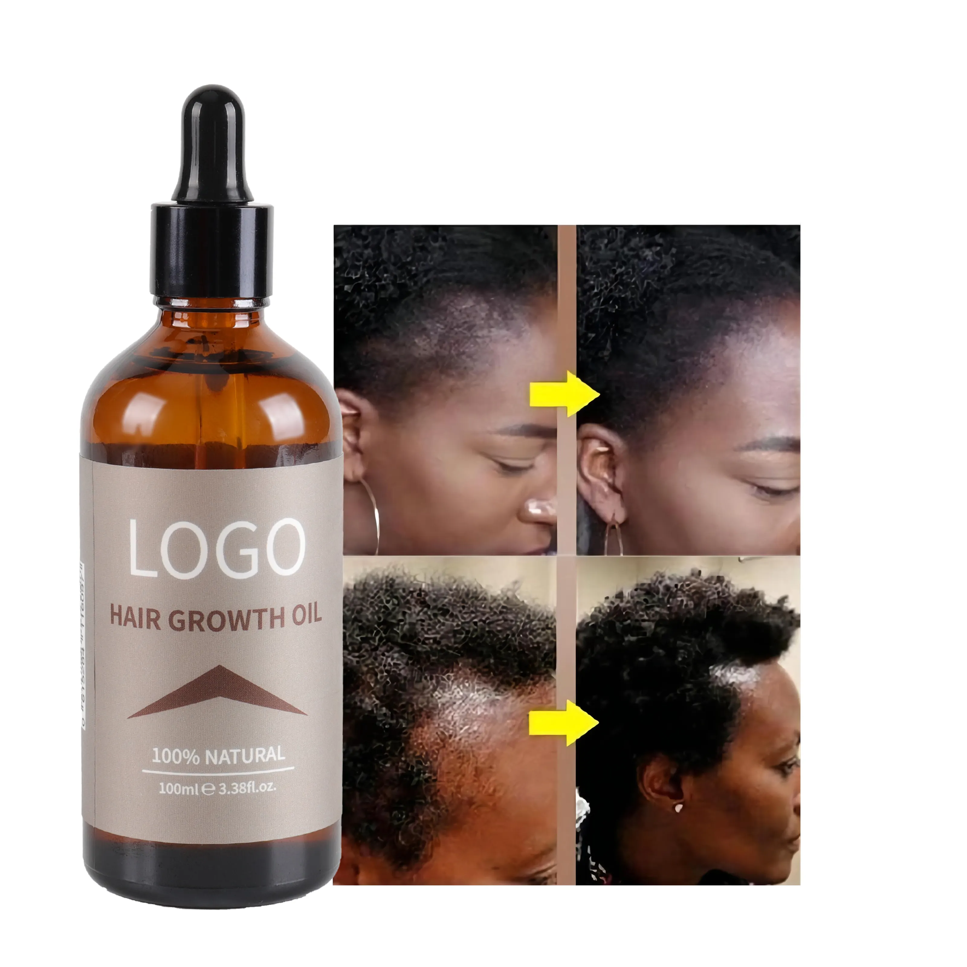OEM Private Label Organic Strengthening Repair hair treatment Extract Hair Growth Oil Keratin hair care shine Serum