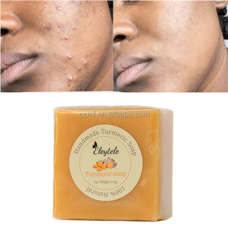 Natural Herbal Private label cura della pelle Anti Acne Vegan Organic Dark Spots Remover pulizia del viso bagno per il corpo curcuma curcuma sapone