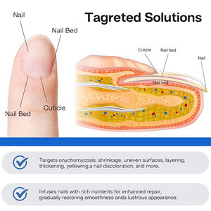 Nagelverzorging Schimmel Behandeling Verminderen Dikte Natuurlijke Kruiden Anti Schimmel Nagelvlekken - Product Image 5