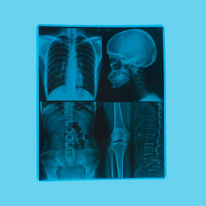 ฟิล์มสัตว์เลี้ยงกันน้ำปรับแต่งได้สำหรับ Epson/OKI/fuji/xerox pr-ct CR DR A4/A3/8x1 0/14X17ขนาด - Product Image 1