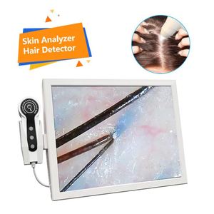 Nouveau produit : Détecteur de follicules pileux, analyseur de peau et de cuir chevelu / Appareil d'analyse du cuir chevelu avec imagerie à lentilles 50X 200X - Product Image 1