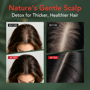Shampoo Esfoliante Antiforfora per Pulizia Profonda del Cuoio Capelluto con Olio di Batana, Allevia il Prurito, Esfoliante per Capelli - Product Image 4