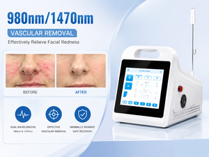 Élimination portable des varices et des télangiectasies au laser 980nm/1470nm – Traitement des capillaires et des angiomes de la <span class=keywords><strong>cerise</strong></span> - Product Image 1