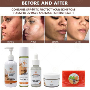 Paket Perawatan Kulit Tubuh Anti-Penuaan Kunyit Khusus, Pemutih Flek Hitam, Serum Organik, Sabun, Pembersih Wajah, Losion, Diperkaya Vitamin C - Product Image 5