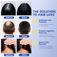 Sérum capillaire MELAO 10000ppm GHK-Cu AHK-Cu au peptide de cuivre pour la densité des cheveux, sérum au peptide de cuivre GHK-Cu pour la croissance des cheveux, contre la chute et l'amincissement des cheveux