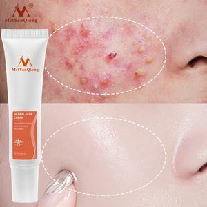 Meiyanqiong <span class=keywords><strong>Crema</strong></span> y loción facial a base de hierbas de alta calidad, antiacné y eliminación de cicatrices para pieles grasas con manchas de acné - Product Image 2